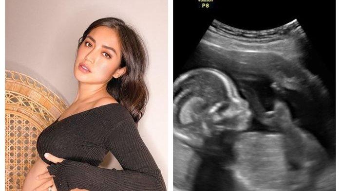 Potret Jessica Iskandar yang kini sedang hamil 8 bulan. Takut soal satu hal.