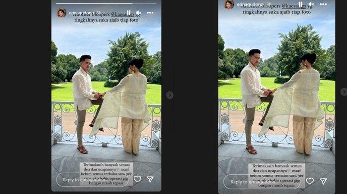 Kondisi terkini Erina Gudono yang baru saja menjalani operasi gigi. (Instagram/@erinagudono)