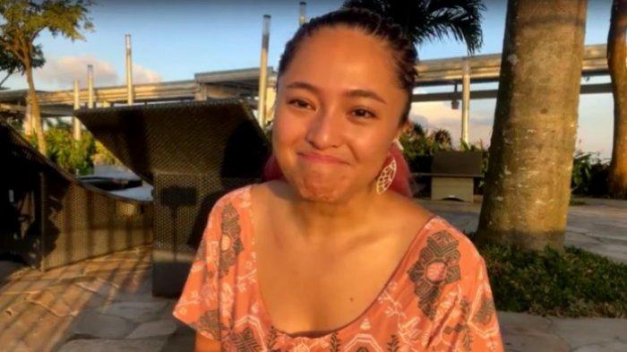 Marshanda unggah video umumkan dirinya mengidap tumor payudara