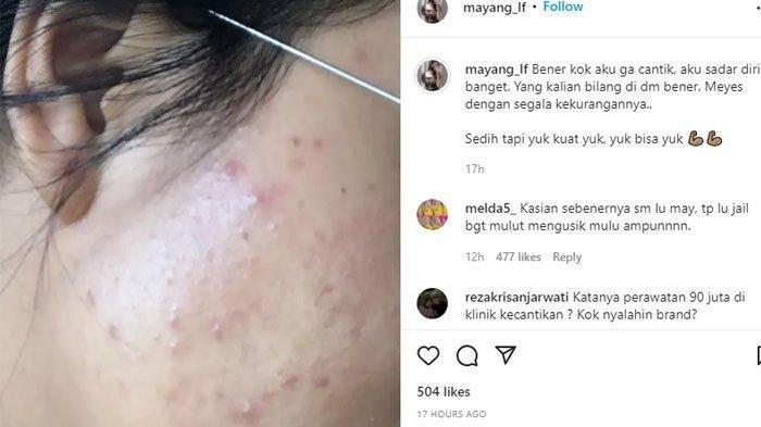 Penamakan wajah mayang yang dianggap rusak karena salah menggunakan skincare