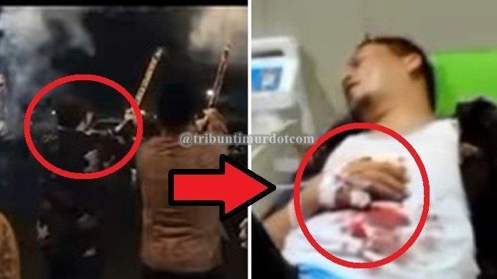 Video Detik-detik Kembang Api Meledak di Tangan Wakil Bupati Kaur Herlian Muchrim, 2 Jarinya Putus