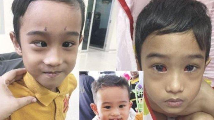 Juling karena Terlalu Sering Main Gadget