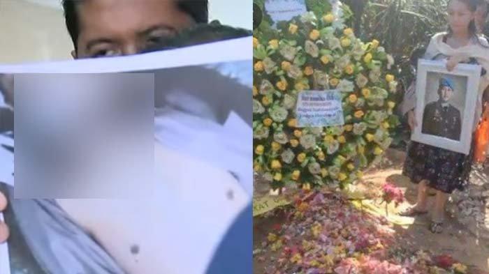 pengacara bongkar luka jeratan di leher Brigadir J, desak bongkar makam korban untuk autopsi ulang