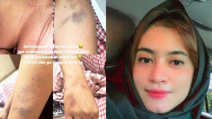 Riri Aprilia, selebgram asal Riau yang menjadi korban penganiayaan oknum Polwan dan ibunya