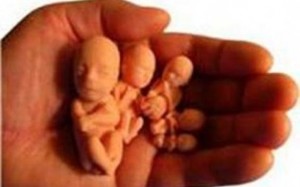 Melakukan Aborsi, Risiko yang Bisa Terjadi pada Anda