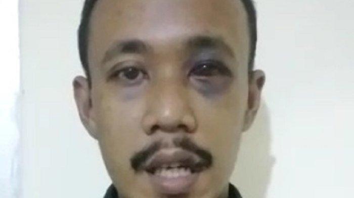 Laporan Palsu babak belur