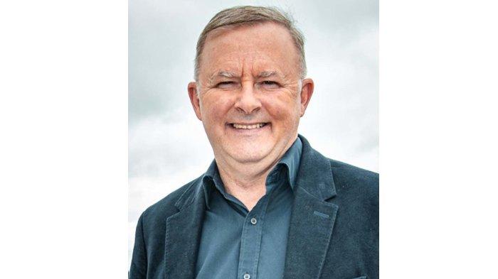Anthony Albanese