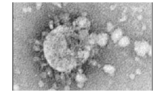 Ilustrasi Adenovirus