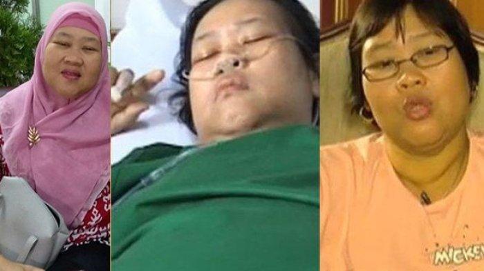 Rini S Bon Bon Meninggal Dunia, Ini Ceritanya Lawan Diabetes, Terbaring Lemas Lalu Divonis Amputasi