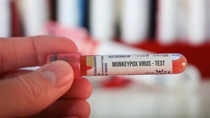 Tes-PCR-Monkeypox.jpg