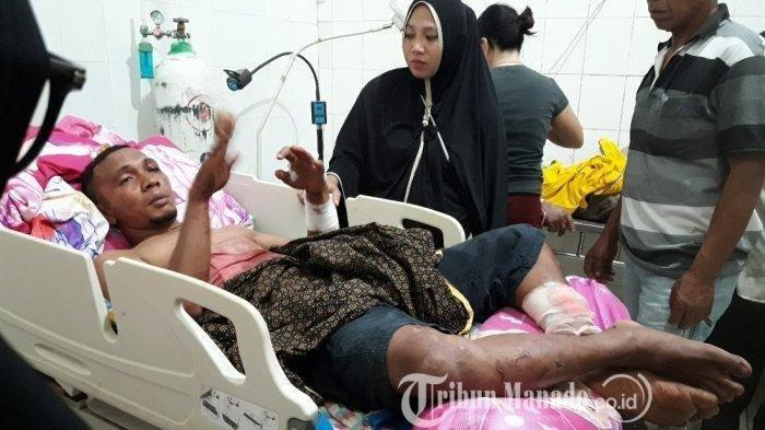 Deni Mamonto korban selamat longsornya tambang emas Bakan, Kabupaten Bolaang Mongondow saat dirawat di RSUD Kotamobagu